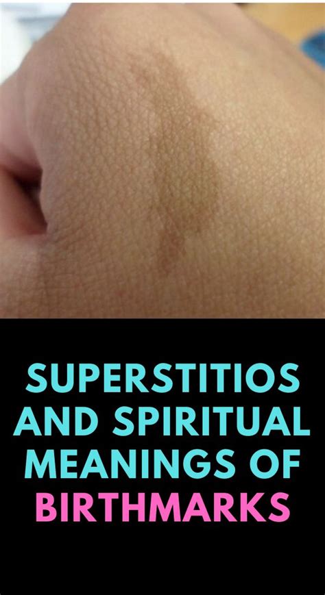 Birthmarks Spiritual Meanings And Superstitions Spiritual Meaning