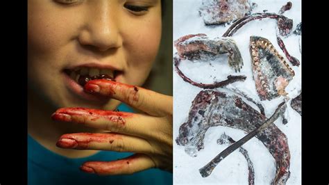 Symptoms include obesity, undereating, and bulimia. Top 10 Most DISTURBING Eating Addictions ( My Strange ...
