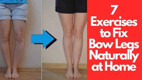 Top 7 Exercises To Fix Bow Legs Naturally At Home Bow Legged Bow