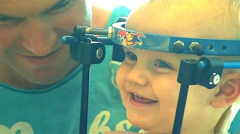 Toddler Recovering After Miracle Operation To Reattach His Head To