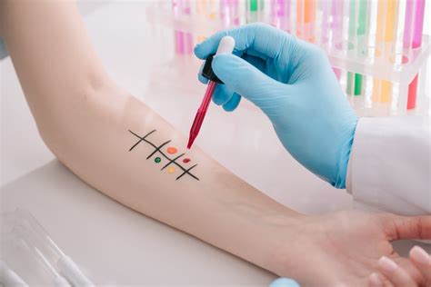 The higher the level of ige, the more likely you are to have an allergy to that particular food. Allergy Skin Test: Everything You Need to Know | Dr. Amy ...