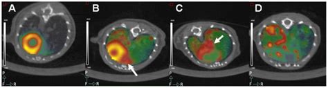 Pet scans are often combined with ct scans to produce even more detailed images. (A) Control PET scan after regular diet in a non-LPS ...