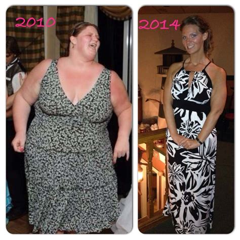 Logging your meals and associated data in a food journal is one of the best ways to restart your weight loss and avoid sliding backward. How To Restart Weight Loss After Gastric Sleeve Surgery