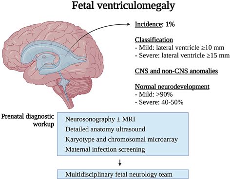Fetal Cerebral Ventriculomegaly What Do We Tell The Prospective