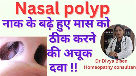 Nasal Polyp Nasal Polyp Homeopathy Medicine Nasal Polyp Treatment