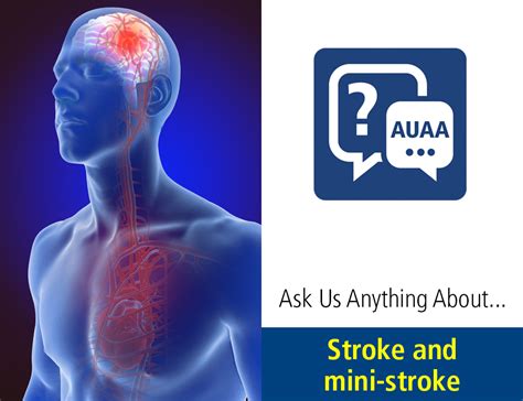 ask us anything about… stroke and mini strokes penn state health news