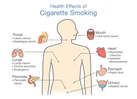 The Health Effects Of Cigarette Smoking A Deadly Habit