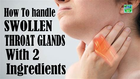 How To Handle Swollen Throat Glands With 2 Ingredients Youtube