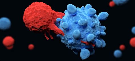 What Is Multiple Myeloma
