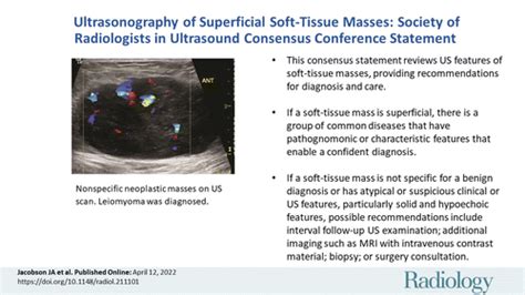 Ultrasonography Of Superficial Soft Tissue Masses Society Of