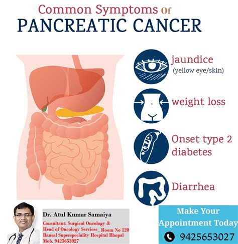 A Guide To Pancreatic Cancer Cancer Specialist