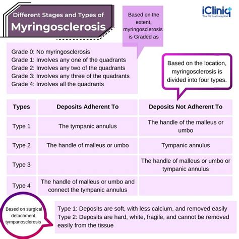 What Is Myringosclerosis