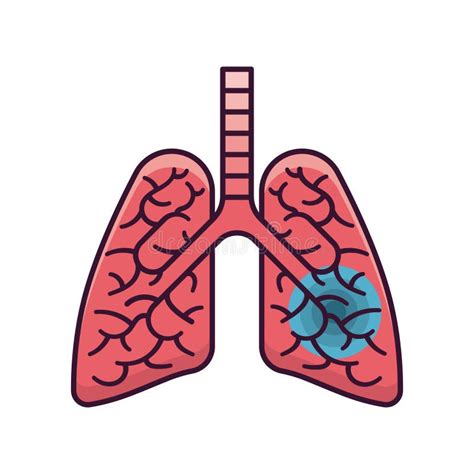 Infected Human Lungs Isolated Vector Illustration Stock Vector