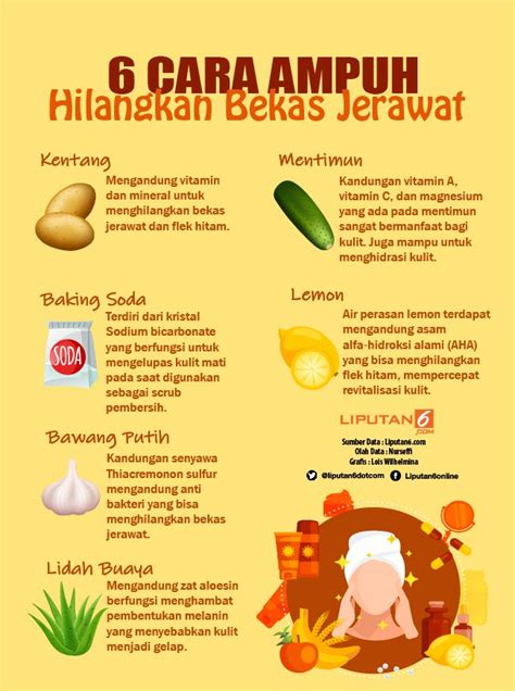 Bagi banyak orang dahi termasuk area bermasalah karena letaknya begitu dekat dengan rambut, yang menghasilkan. Apakah Kacang Bisa Menyebabkan Jerawat - Jawaban Soal 2021