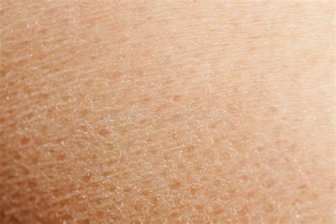 Dry Skin Stock Photo Image Of Macro Flake Health Skin 10610394