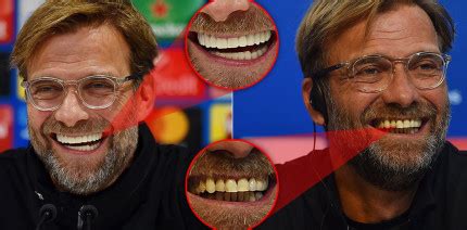 Klopp a fost numit manager al liverpool în 2015. Neue Zähne für Jürgen Klopp: Blendende Strategie des FC ...