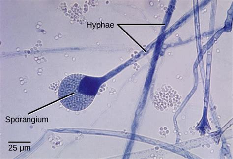 Post a question or comment about what for example, if you are looking for what stachybotrys chartarum spores and growth structures or conidiophores look like under. Characteristics of Fungi | Biology II