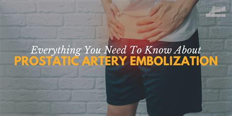 Everything You Need To Know About Prostate Artery Embolization Bay Imaging Consultants