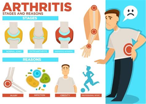 Arthritis Stages And Reasons Of Disease Poster With Text Vector Normal Joint Osteoarthritis