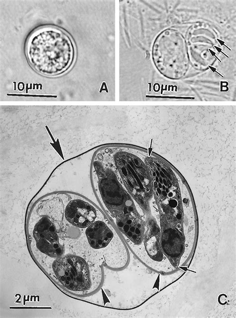 Structures Of Toxoplasma Gondiitachyzoites Bradyzoites And