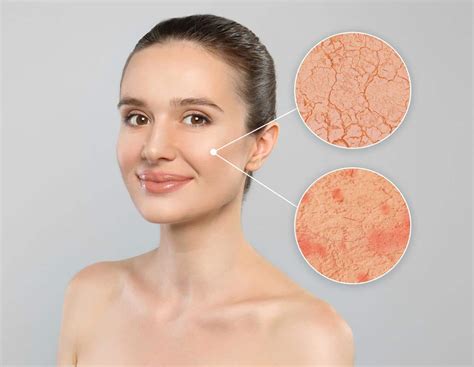 8 Signs You Probably Have Sensitive Skin Viviane Woodard Skincare