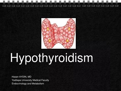 Ppt Hypothyroidism Powerpoint Presentation Free Download Id9105421