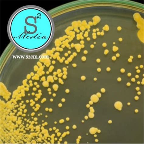 The standard plate count method consists of diluting a sample with sterile saline or phosphate buffer diluent until the bacteria are dilute enough to count accurately. Plate Count Agar (PCA)/Standard Methods Agar (SMA)