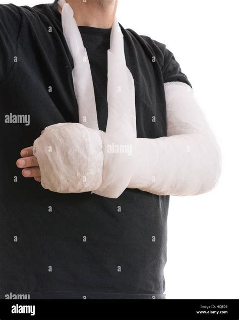 Broken Elbow Hi Res Stock Photography And Images Alamy