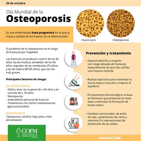20 De Octubre Día Mundial De La Osteoporosis Blog Cofm