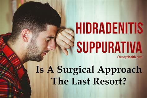 Hidradenitis Suppurativa Treatment With Surgery Is A Surgical Approach