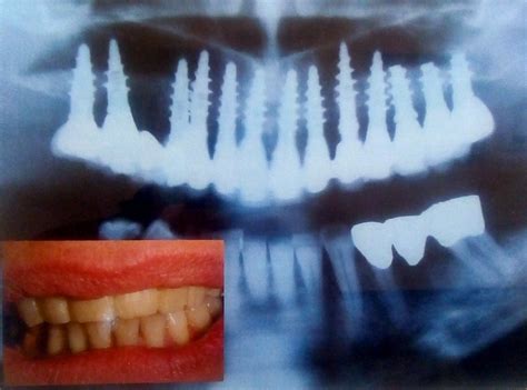 Being one of the top dental clinic in petaling jaya (l&m dental clinic). Lavori ed Impianti Eseguiti - Ambulatorio Odontoiatrico ...