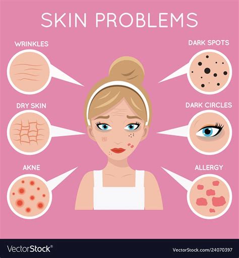 Skin Problems Face Women Cosmetic Care Problem Vector Image On Vectorstock