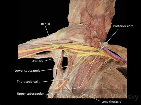 Brachial Plexus Teach Me Anatomy Images And Photos Finder