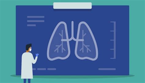 The diagnostic evaluation has three simultaneous steps (tissue diagnosis, staging, and functional evaluation), all of which affect treatment planning and determination of prognosis. Small cell lung cancer symptoms, diagnosis and treatment ...