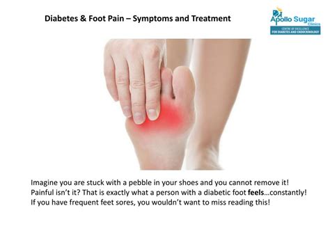 Ppt Diabetes And Foot Pain Symptoms And Treatment Powerpoint