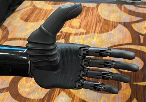 New Ai Powered Prosthetic Hand Can Be Moved With Your Mind Gizmochina