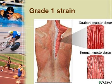 Sport Injuries Physiological Resposes Muscle Strain