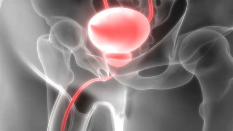 Prostata Infiammata Cause Sintomi Diagnosi Cure