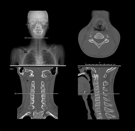 What Are The Types Of Ct Scans Two Views
