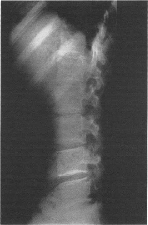 Simple Science: How to Make a Volcano with Kids