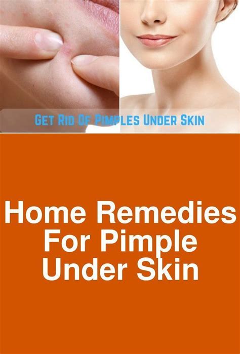 Home Remedies For Pimple Under Skin Pimples Under The Skin Cannot Be