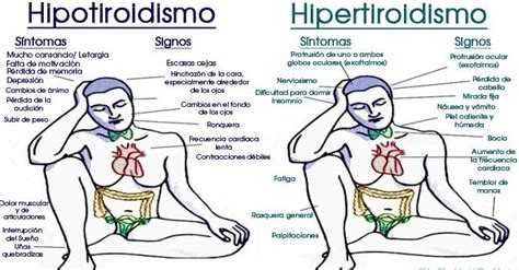 Hipotiroidismo E Hipertiroidismo Aprende Sus Diferencias Signos Porn