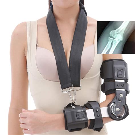 Buy Rom Hinged Elbow Brace Adjustable Post Op Full Length Splint