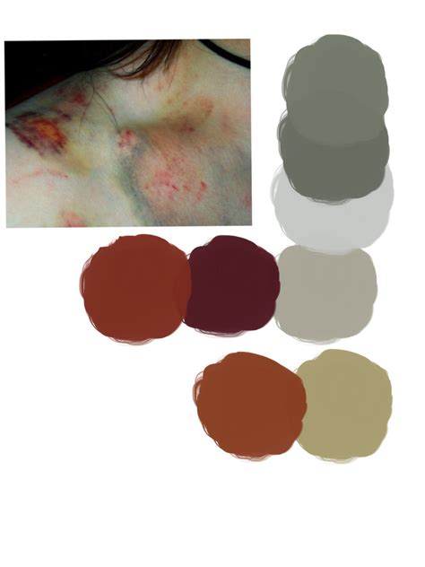 How To Draw Bruises Howtofg