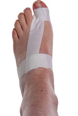 It is caused by a vigorous upward bending of the big toe. Turf Toe Taping | Physical Sports First Aid Blog