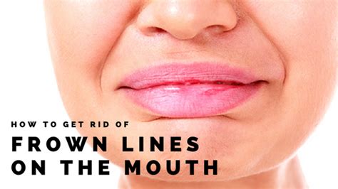 How To Get Rid Of Frown Lines On The Mouth Erase Cosmetics