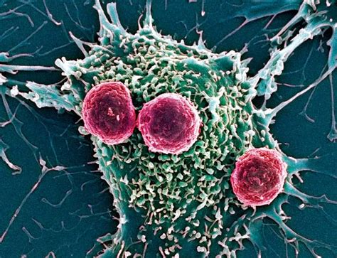 Cancer Meets Its Nemesis In Reprogrammed Blood Cells New Scientist