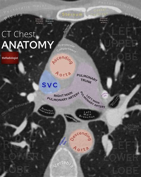 Theradiologist On Twitter Axial Ct Chest Anatomy Showing The