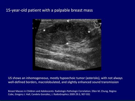 Ultrasound Of Pediatric And Adolescent Breast
