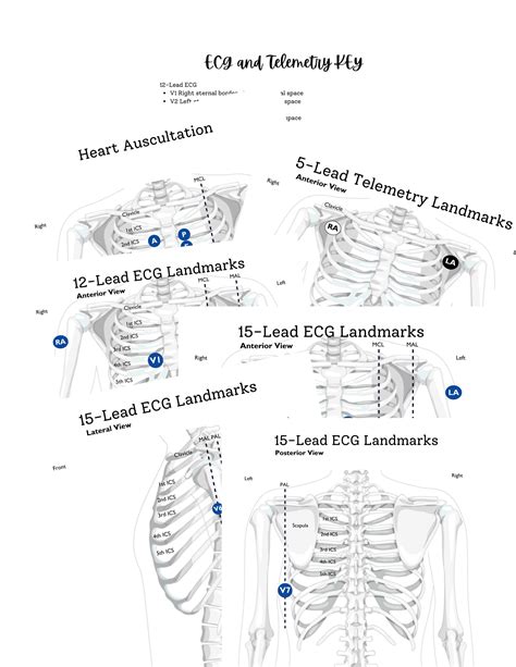 Ecg Lead Placement Activity For 12 Lead 15 Lead And 5 Lead Etsy